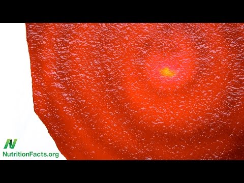 Video: Beeturia: Zašto Repe Uzrokuje Ružičaste Pee Kod Nekih Ljudi, A Ne Kod Drugih