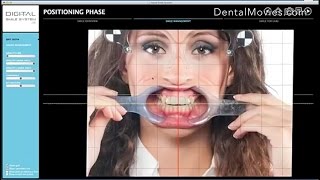 Digital Smile System 1.0.6 Tutorial screenshot 1