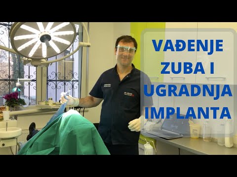 Vađenje zuba i ugradnja implantata u jednoj poseti - Prikaz slučaja