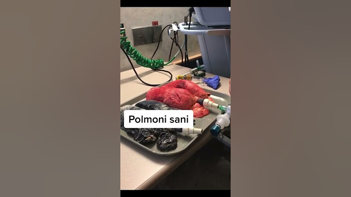 Polmoni sani vs polmoni di un fumatore #shorts