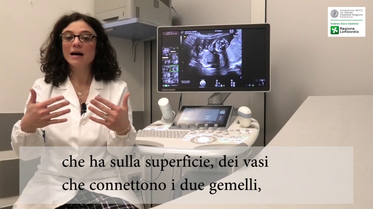 diabetes tipo 1 y gravidanza gemellare