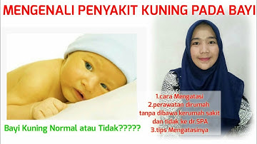 MENGENALI PENYAKIT KUNING PADA BAYI