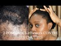 2 pommades miracle contre les chutes de cheveux  comment faire pousser ses cheveux rapidement