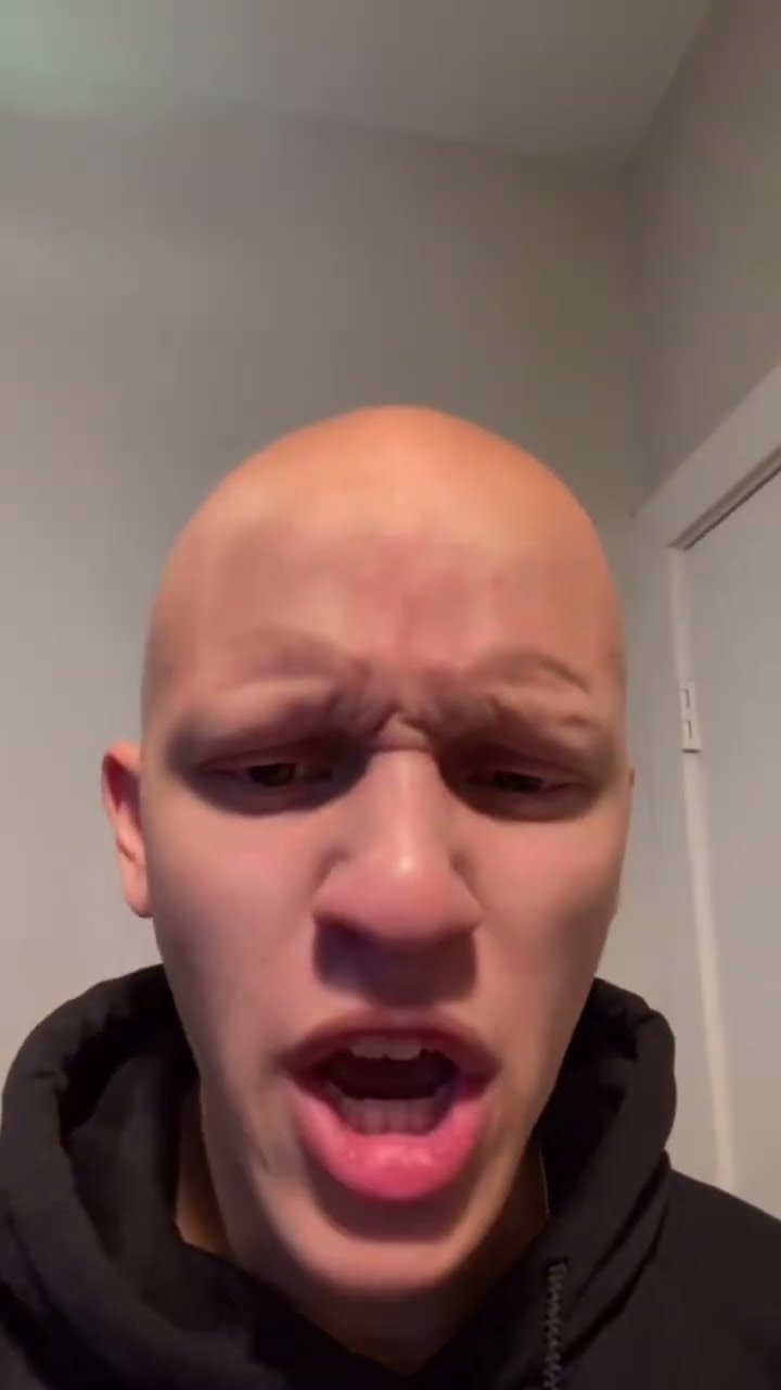 Don’t watch until the end #Comedy #Funny #Alopecia ￼