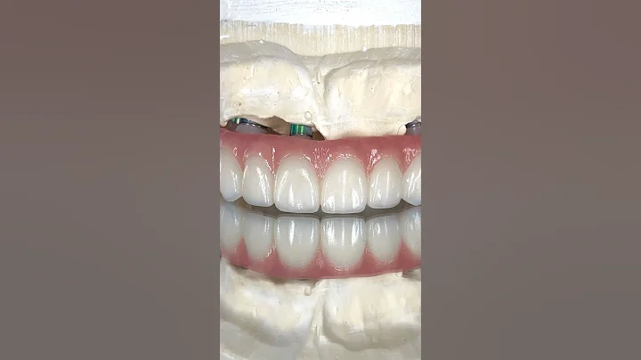 Amazing Full Mouth Zirconia Arch Implant #lsk121shorts #dentist #teeth