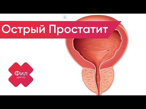 Острый ПРОСТАТИТ Лечение | Как вылечить ПРОСТАТИТ дома | ПРОСТАТИТ диагностика | ПРОСТАТИТ симптомы