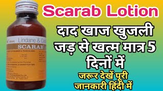 Scarub Lotion | Scarab Lotion Kaise Lagaye | Scarab Lotion Use In Hindi | दाद खाज खुजली जड़ से खत्म