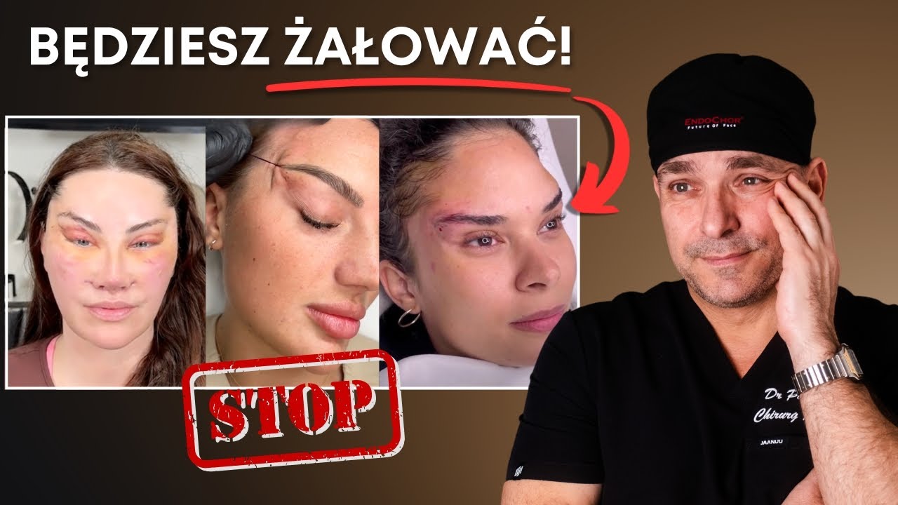 Chirurg Plastyczny: Błędy, które rujnują TWOJĄ twarz!