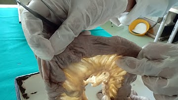 Intestines ! Differences made easy between small and large intestine!