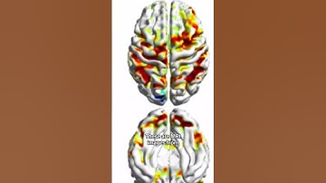 Smartphone addiction is leading to "brain rot," doctors say #shorts