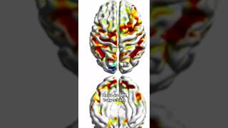 Smartphone Addiction Is Leading To Brain Rot, Doctors Say