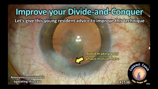 CataractCoach 1536: improve your divide and conquer technique screenshot 3