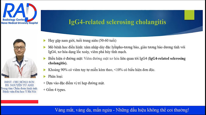 Mắt vàng là dấu hiệu bệnh gì