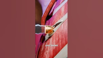 How A Bullet Goes Through A Body 😦
