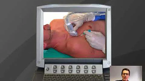 Webinar: Needle Navigation in Ultrasound-Guided Procedures