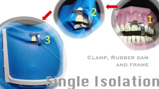 Different Rubber Dam Isolation Techniques, Episode 1 by Dr. Ida Viloria, DMD, Phd