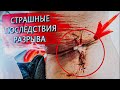 ПОРВАЛ БИЦЕПС / СТРАШНЫЕ ПОСЛЕДСТВИЯ