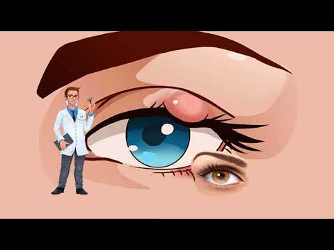 Video: Si mund t'i ndryshoj cilësimet e sythave të pikselit?
