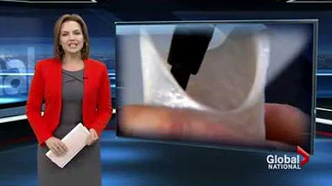 3D-printed limbs for Uganda