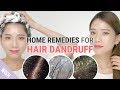 All about Hair Dandruff! | Dandruff Removal Tips | Wishtrend TV