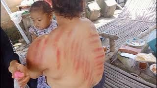 kerokan lengan kanan dan kiri.