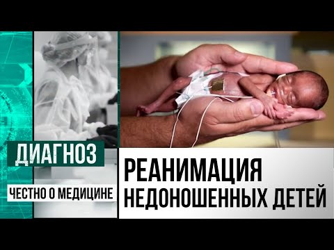 Родиться весом 640 граммов и выжить: как выхаживают недоношенных детей в Казахстане | Диагноз