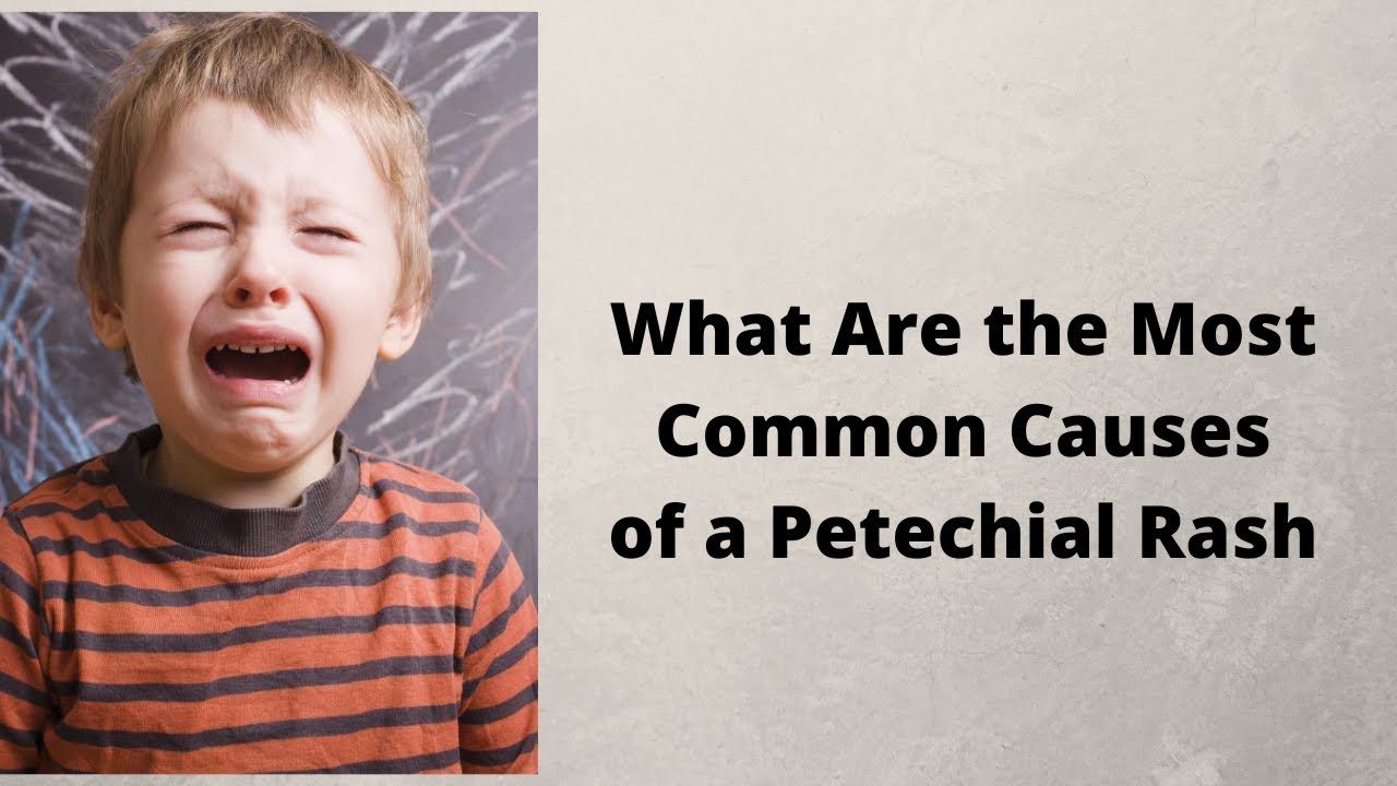 What Are the Most Common Causes of a Petechial Rash - YouTube