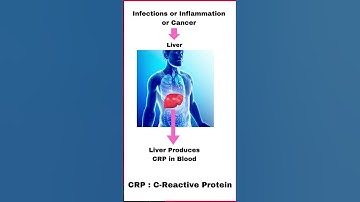 CRP कम कैसे करें ? | C-Reactive Protein | How to reduce CRP