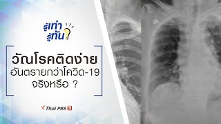 วัณโรคติดง่าย อันตรายกว่าโควิด-19 จริงหรือ ? : รู้เท่ารู้ทัน (24 มี.ค. 64)