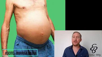 O que fazer para eliminar barriga d'água?