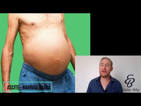 Vídeo: Como tratar a barriga d'água?