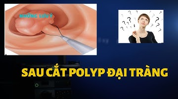 Giải đáp các câu hỏi thường gặp sau cắt polyp đại tràng