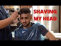 I Got Hair Transplant Surgery