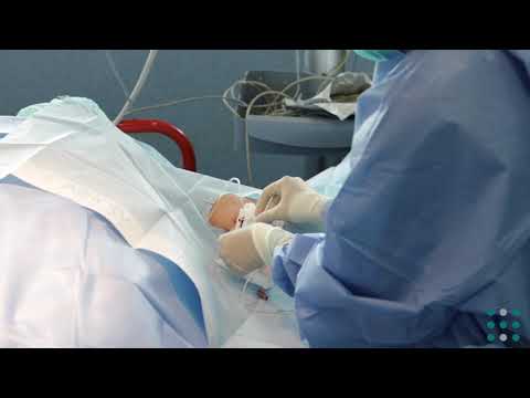 Protocolo de inserción de un catéter central de inserción periférica (PICC) (Vídeo en Catalán)