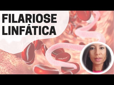 FILARIOSE OU ELEFANTÍASE - Wuchereria bancrofti | PARASITOLOGIA | ENSINO SUPERIOR