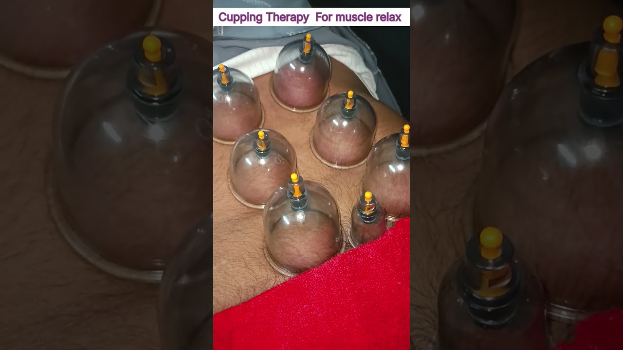 Cupping therapy |Back Muscle relax #fullbodymassage #stiffness #cuppingtherapypoint