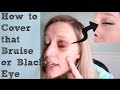 How to Cover  A Black Eye