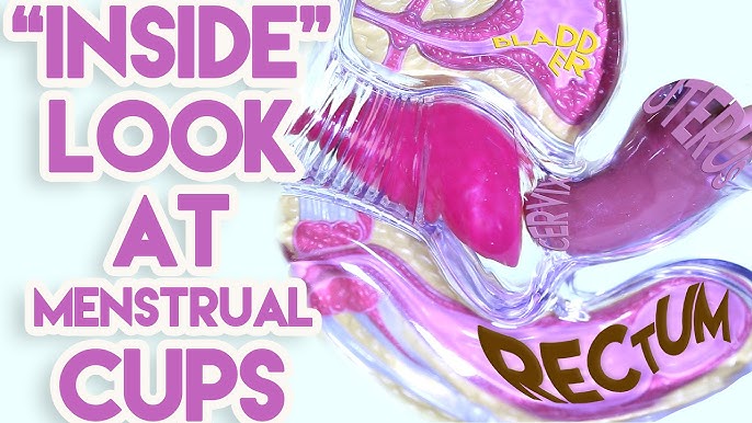 Menstrual Cups vs Menstrual Discs  The Differences - Put A Cup In It