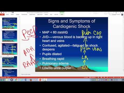 Cardiogenic shock clinical manifestations and treatments