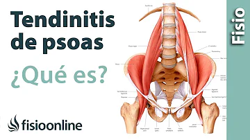 ¿Qué se siente cuando se libera el psoas?