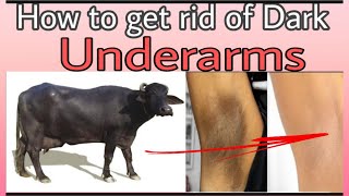 Dark underarms home remedy| Dark under arms treatment hindi |डार्क अंडरआर्म्स के घरेलू नुस्खे|