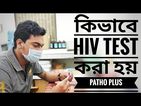 Video: Môžete Mať HIV, Ak Máte Sex S Kondómom?