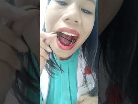 Video: Bagaimana cara melepaskan gigi yang macet dari poros?