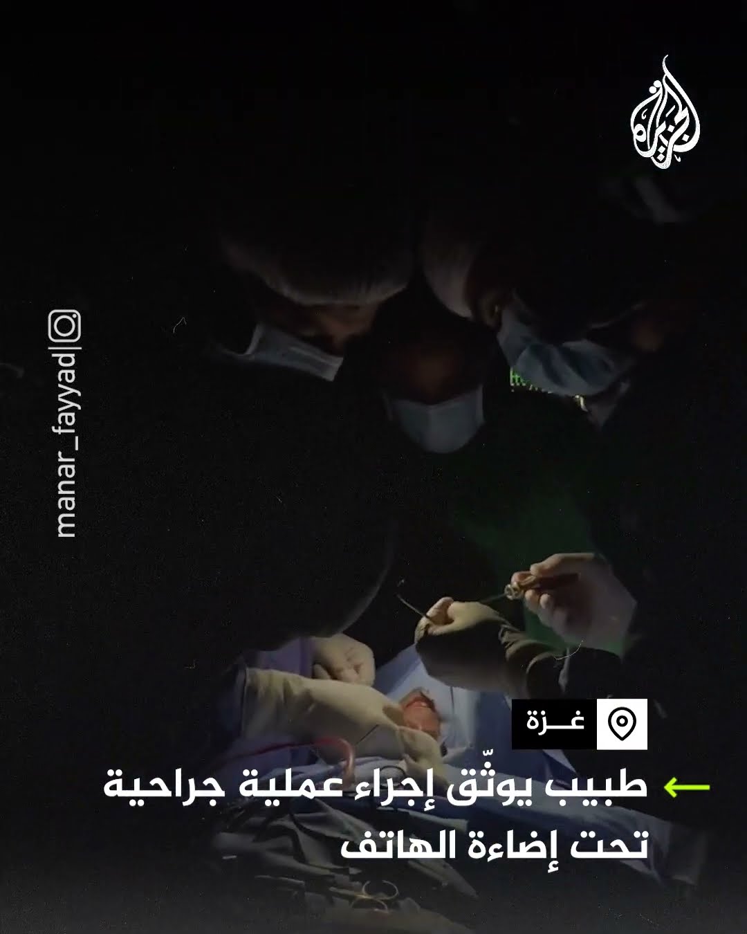 عملية جراحية تحت إضاءة الهاتف في غزة