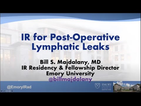 Grand Rounds: IR for Post-Operative Lymphatic Leaks