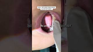 CLEAR RETAINER