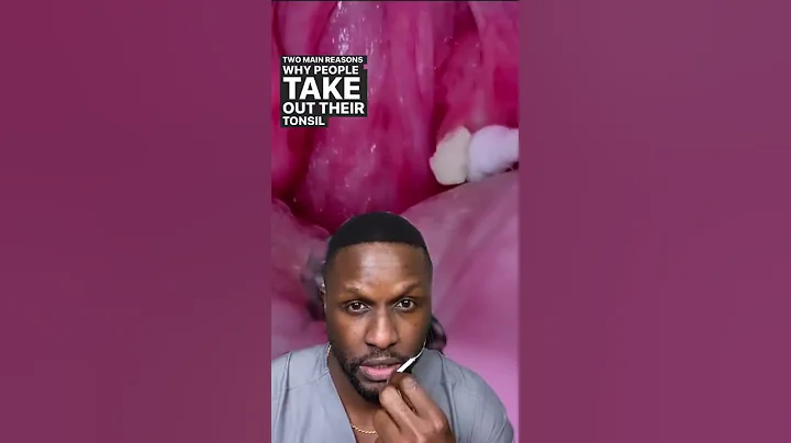 Why Do You Take Out Tonsil Stones? #shorts - DayDayNews