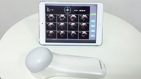 4D Wireless Probe Ultrasound Scanner MSLPU37 video