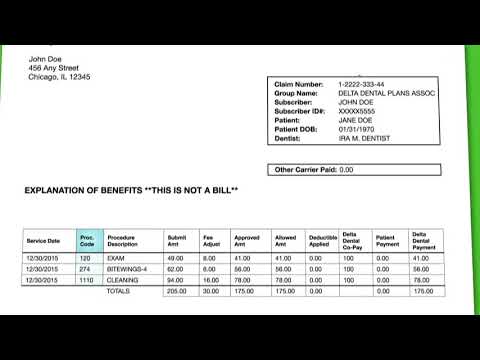 Delta Dental Coverage Chart