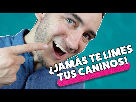 Vídeo: Mamelones En Los Dientes: Por Qué Están Allí Y Cómo Eliminarlos